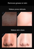 BeNat - Volcanic Stone Oil-Absorbing Face Roller